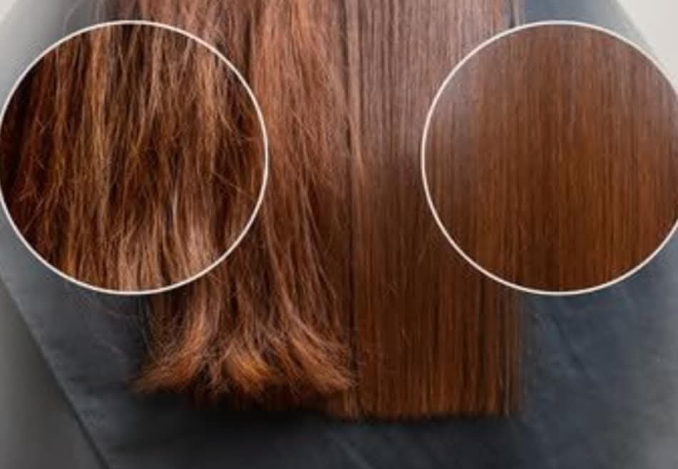 جهاز ازالة تقصف الشعر Enzo - الصورة 6