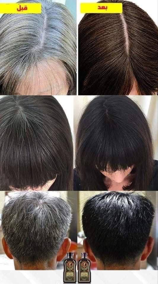 شامبو الشيب الاصلي - الصورة 4