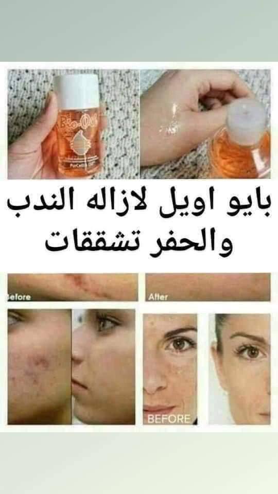 بايو اويل الاصلي - الصورة 11