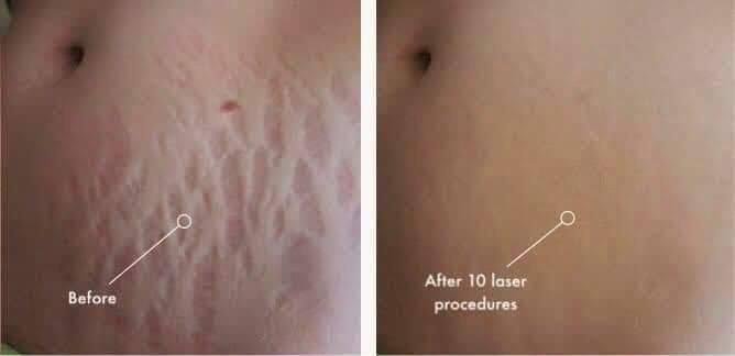 بايو اويل الاصلي - الصورة 7